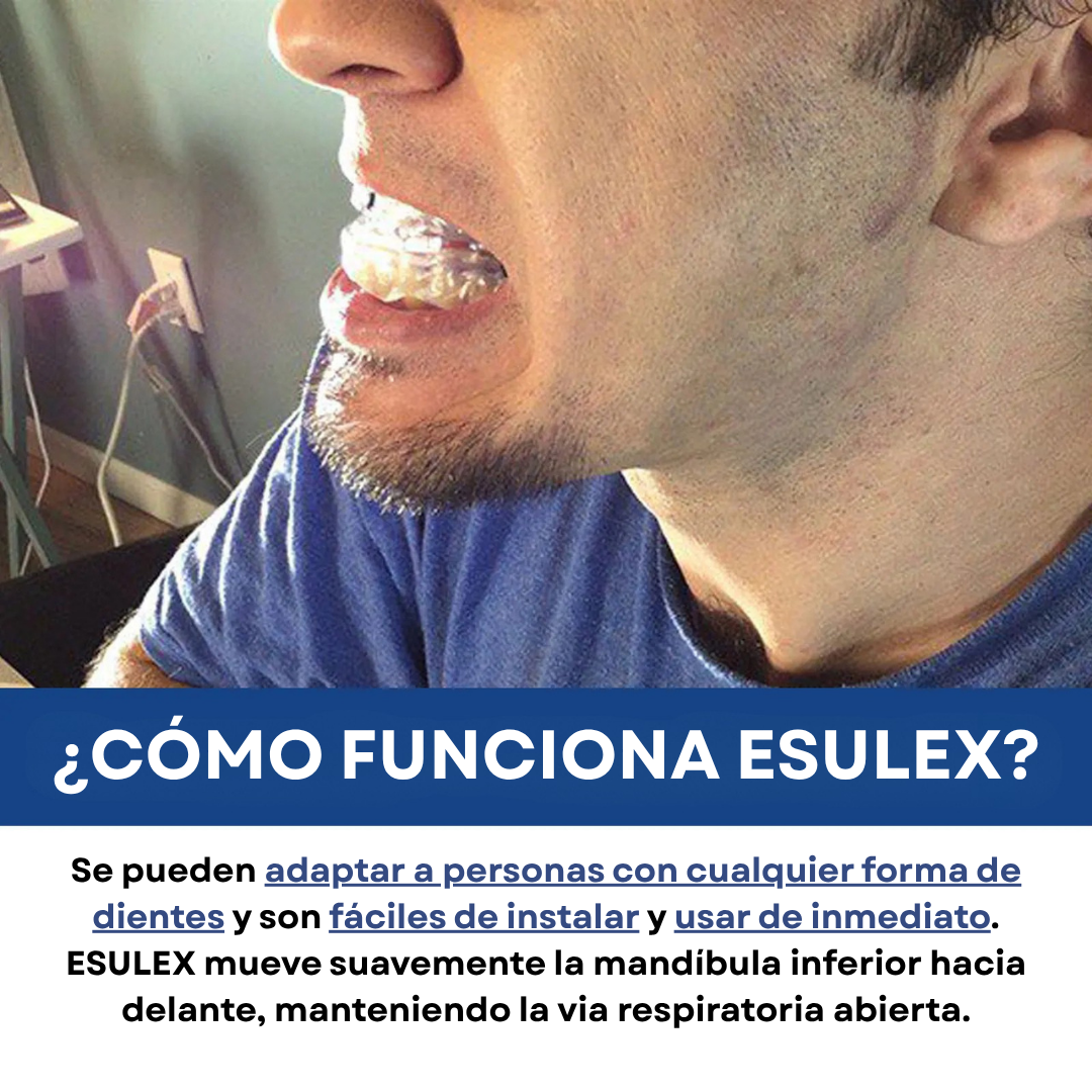 ESULEX - Protector Antirronquidos - Tamaño Universal